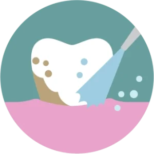 ขูดหินปูน