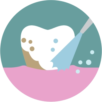 ขูดหินปูน