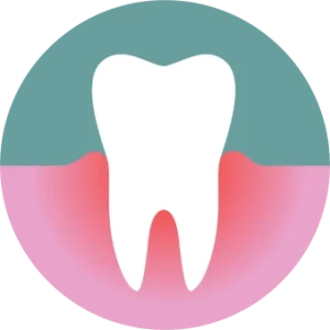 รักษาโรคเหงือก