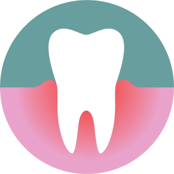 รักษาโรคเหงือก